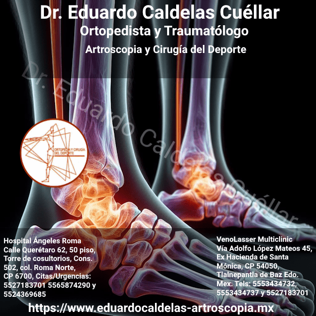 Tratamiento de la osteonecrosis postraumática en la tibia distal con injerto óseo autólogo: reporte de un caso
